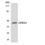 Western Blot - Anti-OPRD1 Antibody (R12-3122) - Antibodies.com