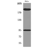 Western Blot - Anti-NTRK3 Antibody (C30067) - Antibodies.com