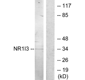 Western Blot - Anti-NR1I3 Antibody (C11053) - Antibodies.com