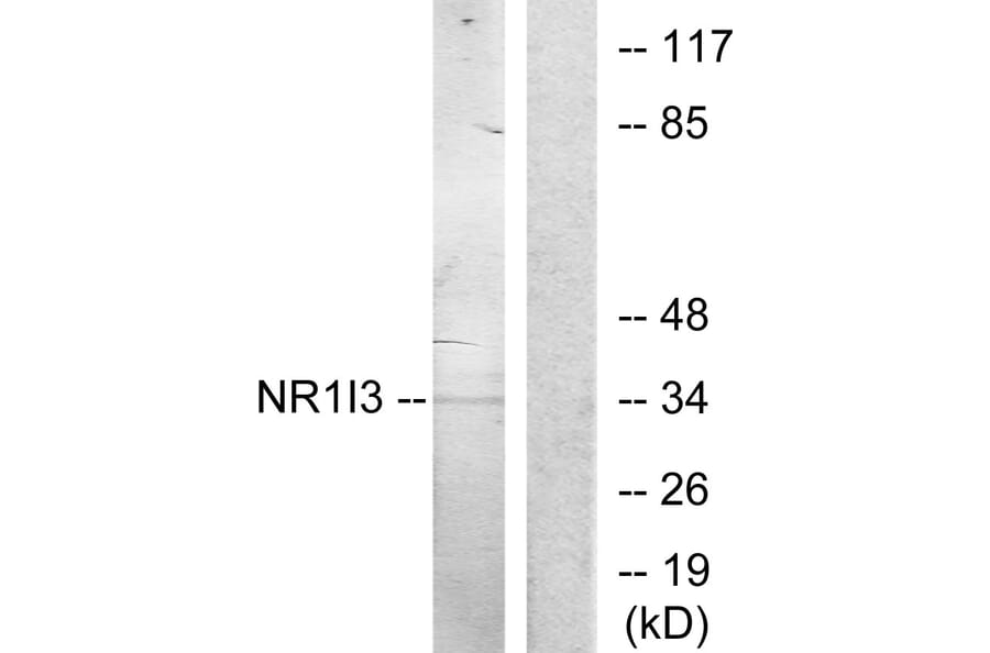 Western Blot - Anti-NR1I3 Antibody (C11053) - Antibodies.com