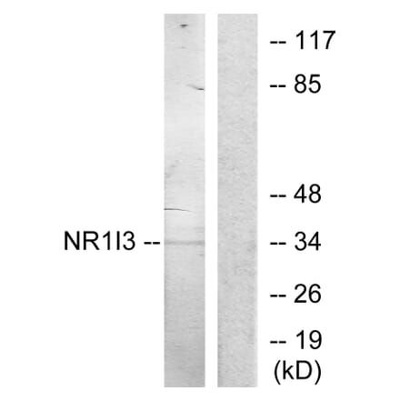 Western Blot - Anti-NR1I3 Antibody (C11053) - Antibodies.com