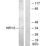 Western Blot - Anti-NR1I3 Antibody (C11053) - Antibodies.com
