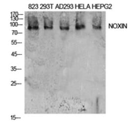 Western Blot - Anti-NOXIN Antibody (C30187) - Antibodies.com