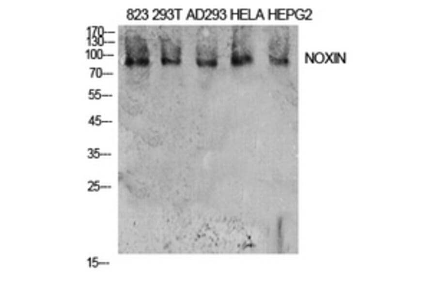 Western Blot - Anti-NOXIN Antibody (C30187) - Antibodies.com