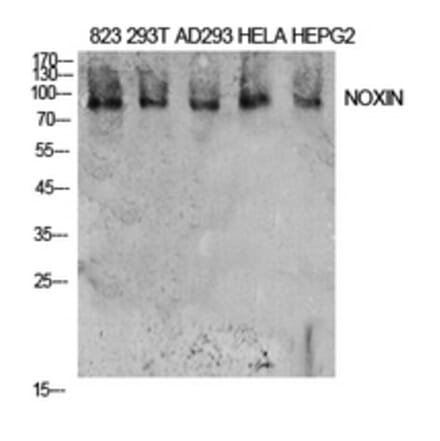 Western Blot - Anti-NOXIN Antibody (C30187) - Antibodies.com