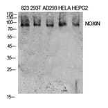 Western Blot - Anti-NOXIN Antibody (C30187) - Antibodies.com