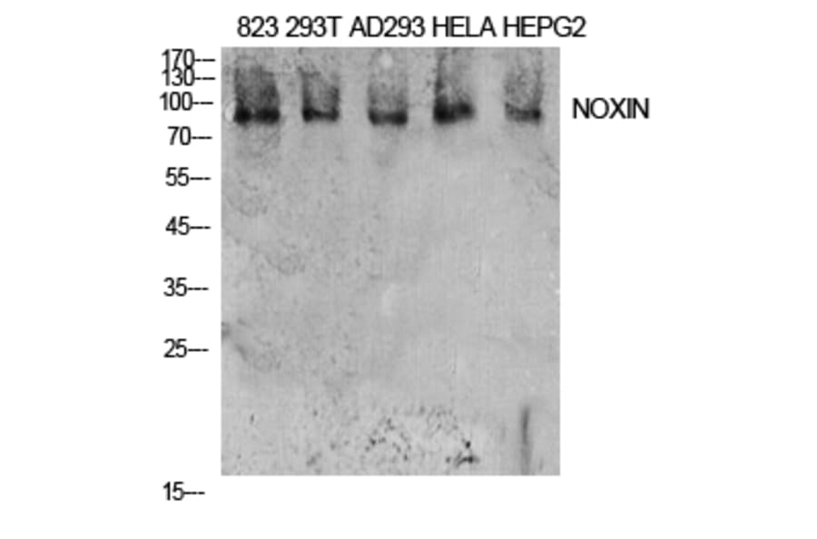 Western Blot - Anti-NOXIN Antibody (C30187) - Antibodies.com