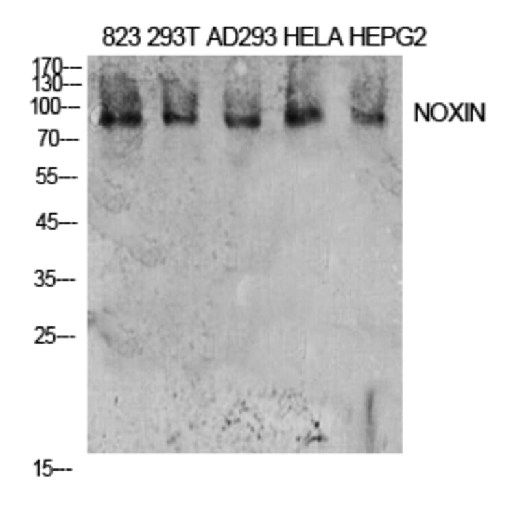 Western Blot - Anti-NOXIN Antibody (C30187) - Antibodies.com