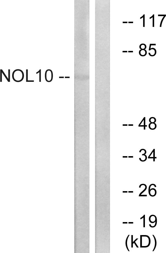 Western blot analysis of lysates from HUVEC cells using Anti-NOL10 Antibody. The right hand lane represents a negative control, where the antibody is blocked by the immunising peptide.