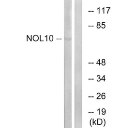 Western Blot - Anti-NOL10 Antibody (C17154) - Antibodies.com