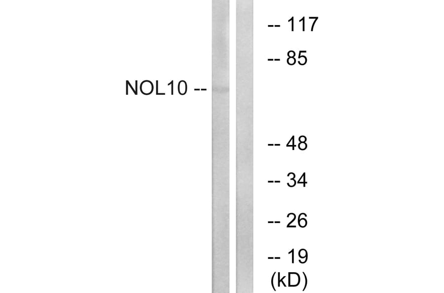 Western Blot - Anti-NOL10 Antibody (C17154) - Antibodies.com