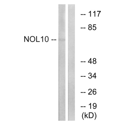 Western Blot - Anti-NOL10 Antibody (C17154) - Antibodies.com