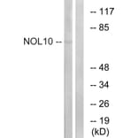 Western Blot - Anti-NOL10 Antibody (C17154) - Antibodies.com