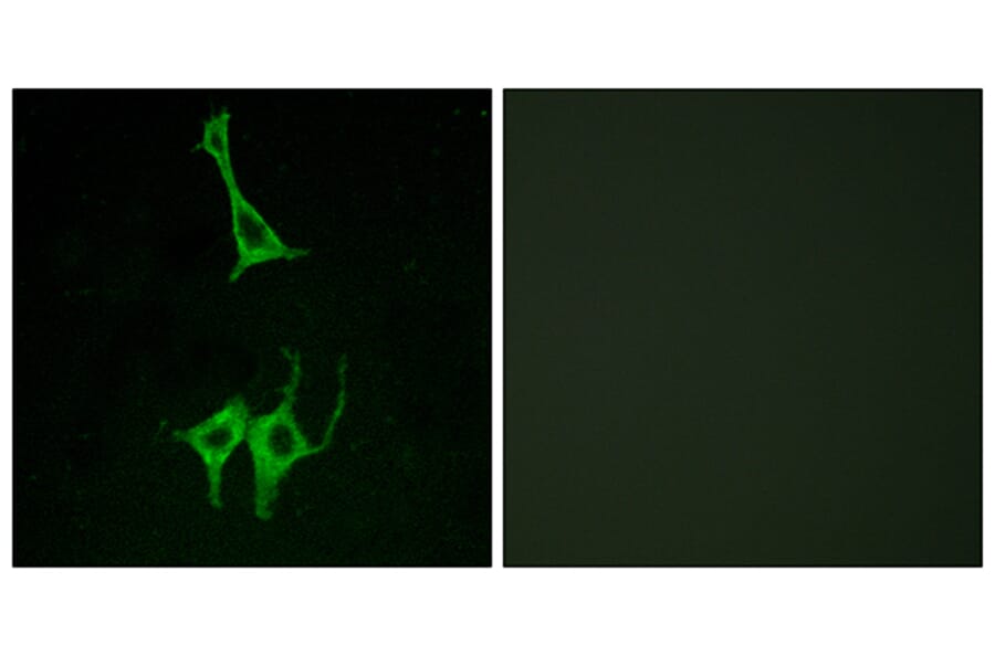 Immunofluorescence - Anti-NMUR1 Antibody (G406) - Antibodies.com