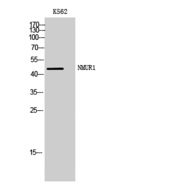 Western Blot - Anti-NMUR1 Antibody (G406) - Antibodies.com