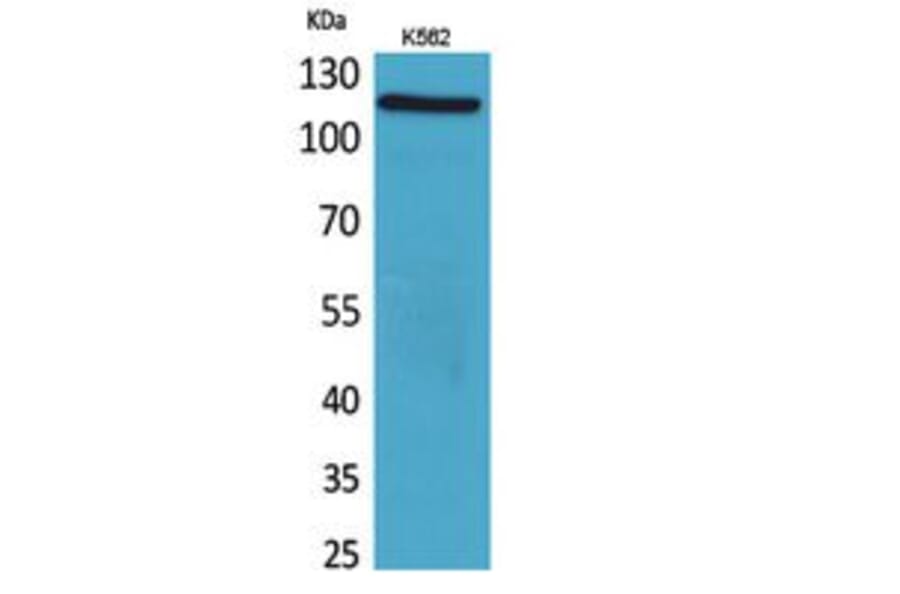 Western Blot - Anti-NLRP3 Antibody (C30251) - Antibodies.com