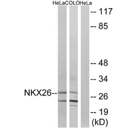 Western Blot - Anti-NKX26 Antibody (C16341) - Antibodies.com