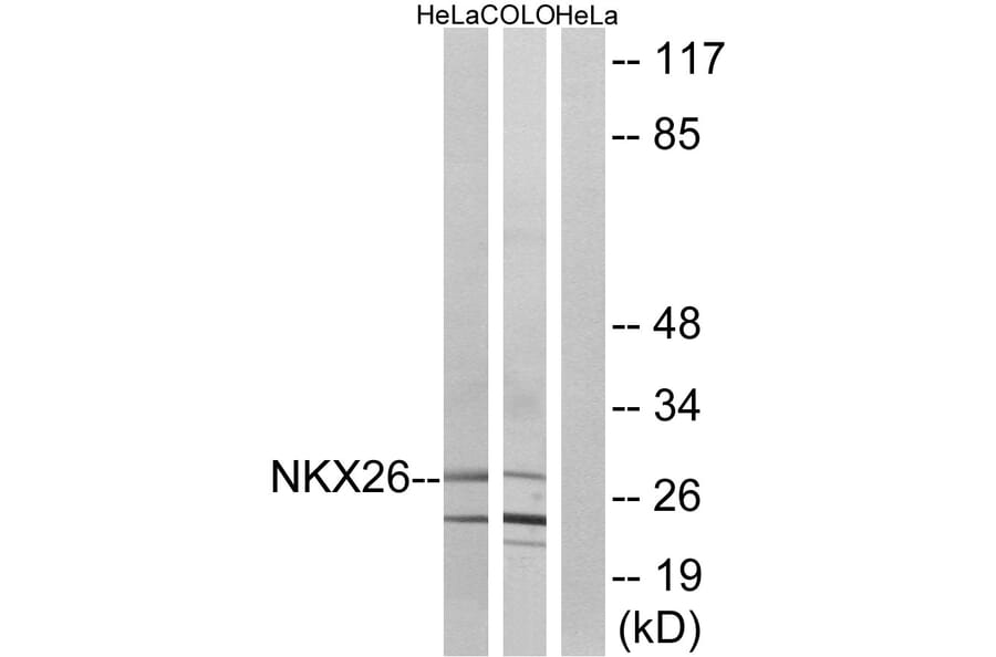 Western Blot - Anti-NKX26 Antibody (C16341) - Antibodies.com