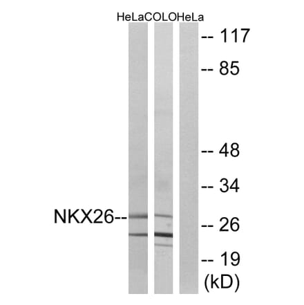 Western Blot - Anti-NKX26 Antibody (C16341) - Antibodies.com