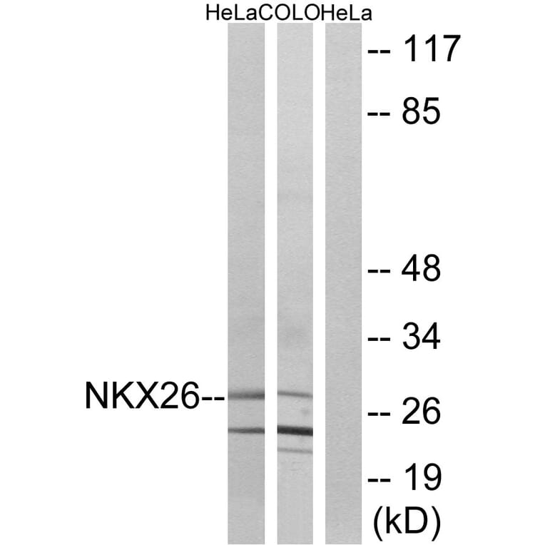 Western Blot - Anti-NKX26 Antibody (C16341) - Antibodies.com