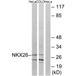 Western Blot - Anti-NKX26 Antibody (C16341) - Antibodies.com