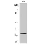 Western Blot - Anti-NKX26 Antibody (C16341) - Antibodies.com