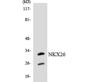 Western Blot - Anti-NKX26 Antibody (R12-3095) - Antibodies.com