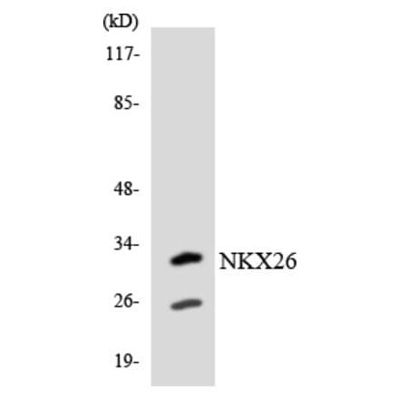 Western Blot - Anti-NKX26 Antibody (R12-3095) - Antibodies.com