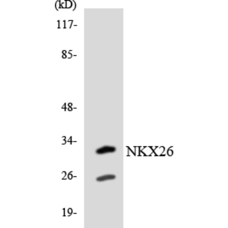 Western Blot - Anti-NKX26 Antibody (R12-3095) - Antibodies.com