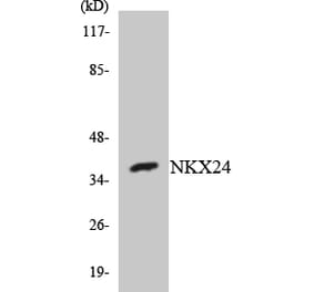 Western Blot - Anti-NKX24 Antibody (R12-3094) - Antibodies.com