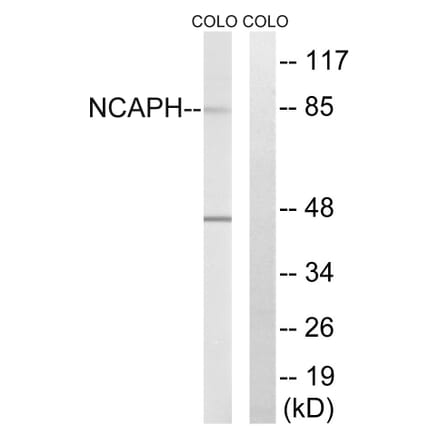 Western Blot - Anti-NCAPH Antibody (C15233) - Antibodies.com