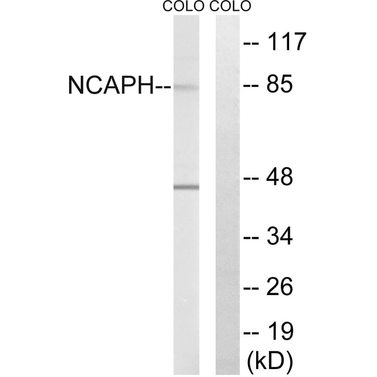 Western Blot - Anti-NCAPH Antibody (C15233) - Antibodies.com