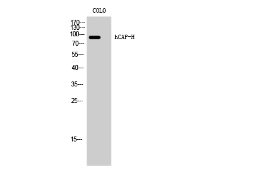Western Blot - Anti-NCAPH Antibody (C15233) - Antibodies.com