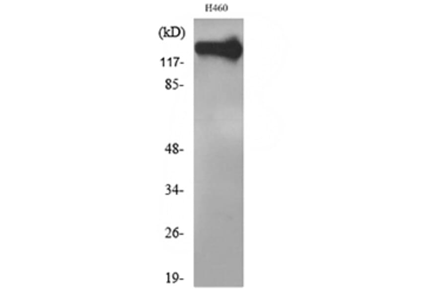 Western Blot - Anti-NCAM1 Antibody (C30017) - Antibodies.com