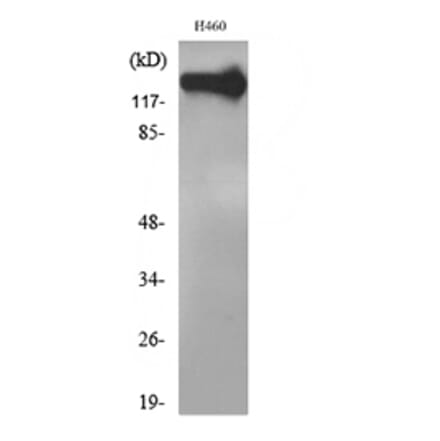 Western Blot - Anti-NCAM1 Antibody (C30017) - Antibodies.com