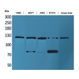 Western Blot - Anti-NCAM1 Antibody (C30017) - Antibodies.com