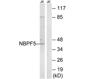 Western Blot - Anti-NBPF5 Antibody (C16930) - Antibodies.com