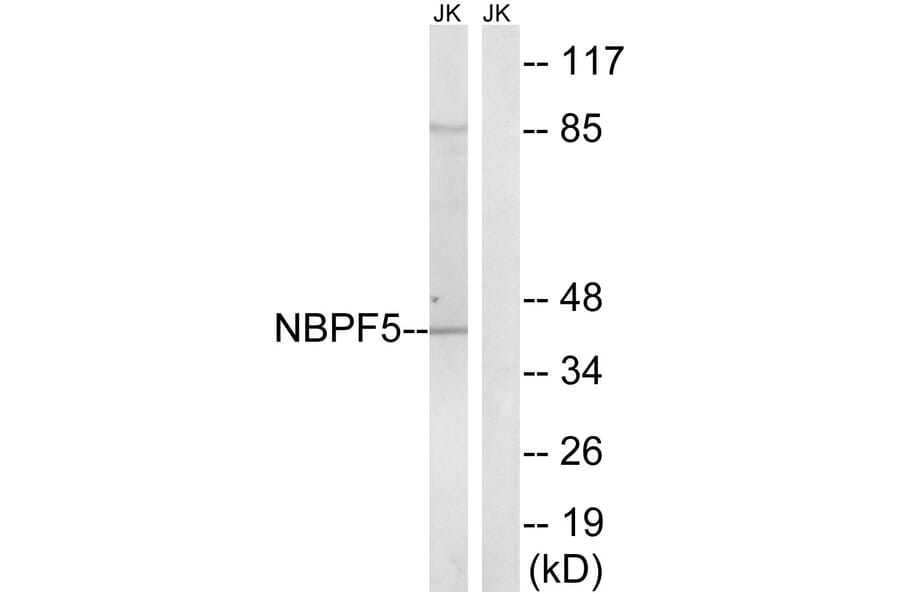 Western Blot - Anti-NBPF5 Antibody (C16930) - Antibodies.com