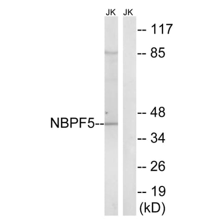 Western Blot - Anti-NBPF5 Antibody (C16930) - Antibodies.com