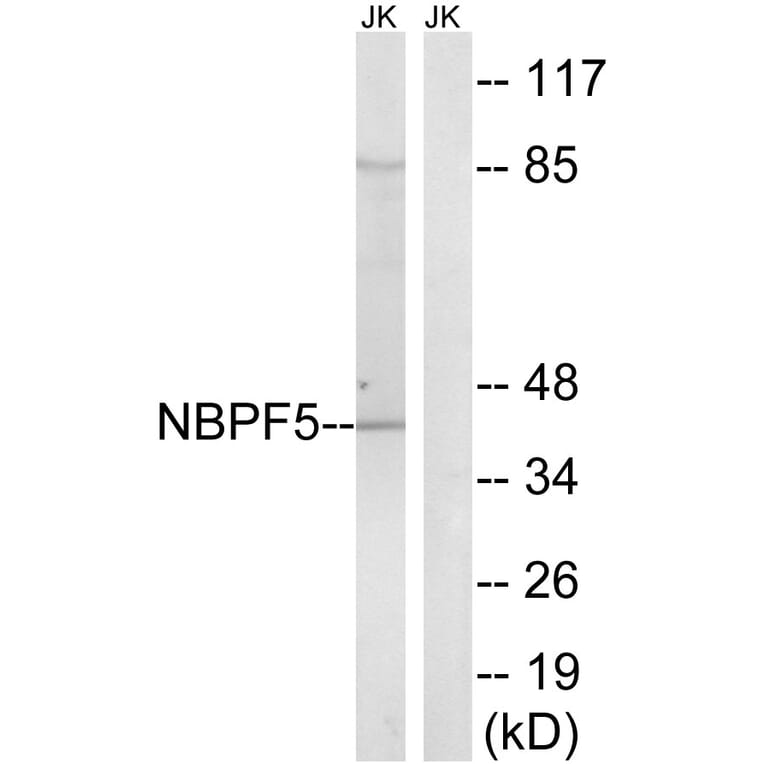 Western Blot - Anti-NBPF5 Antibody (C16930) - Antibodies.com