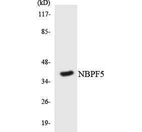 Western Blot - Anti-NBPF5 Antibody (R12-3077) - Antibodies.com