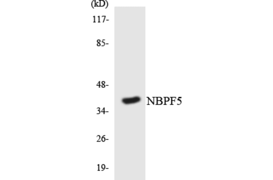 Western Blot - Anti-NBPF5 Antibody (R12-3077) - Antibodies.com