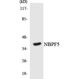 Western Blot - Anti-NBPF5 Antibody (R12-3077) - Antibodies.com