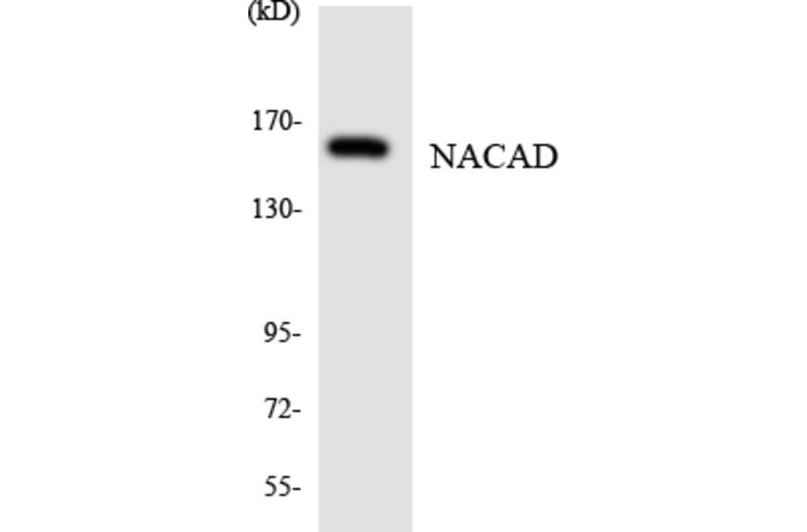 Western Blot - Anti-NACAD Antibody (R12-3072) - Antibodies.com