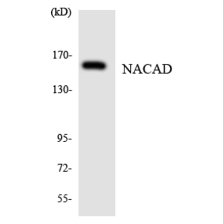Western Blot - Anti-NACAD Antibody (R12-3072) - Antibodies.com