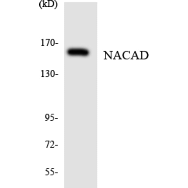 Western Blot - Anti-NACAD Antibody (R12-3072) - Antibodies.com