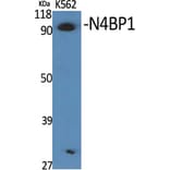 Western Blot - Anti-N4BP1 Antibody (C16877) - Antibodies.com