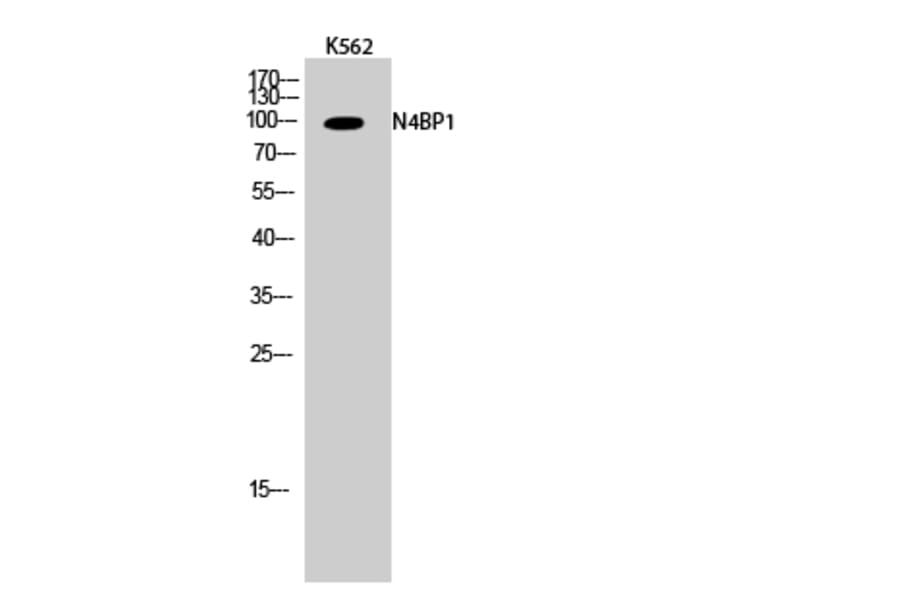 Western Blot - Anti-N4BP1 Antibody (C16877) - Antibodies.com