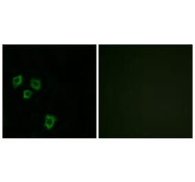Immunofluorescence - Anti-MUC16 Antibody (C11416) - Antibodies.com