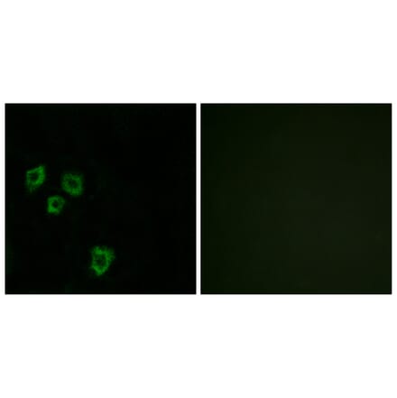 Immunofluorescence - Anti-MUC16 Antibody (C11416) - Antibodies.com